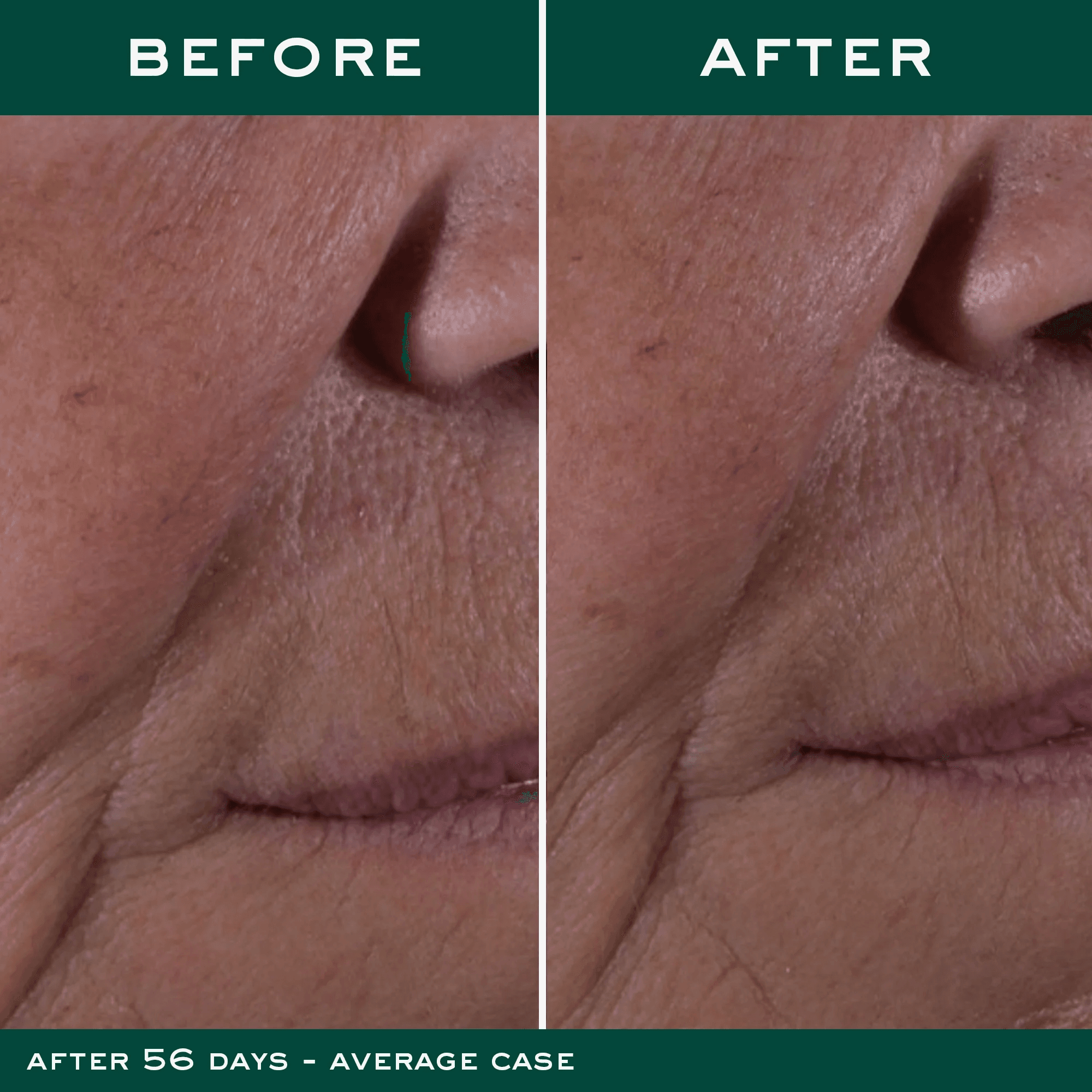 nuxe nuxuriance ultra la crema antiedad global 50ml nuxe nuxuriance ultra la crema antiedad global 50ml
